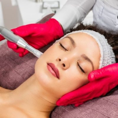 microneedling-guadeloupe_soins